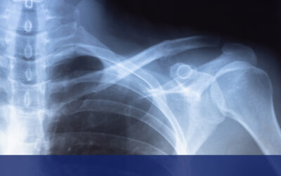 Thanking Him Before We See the Answer